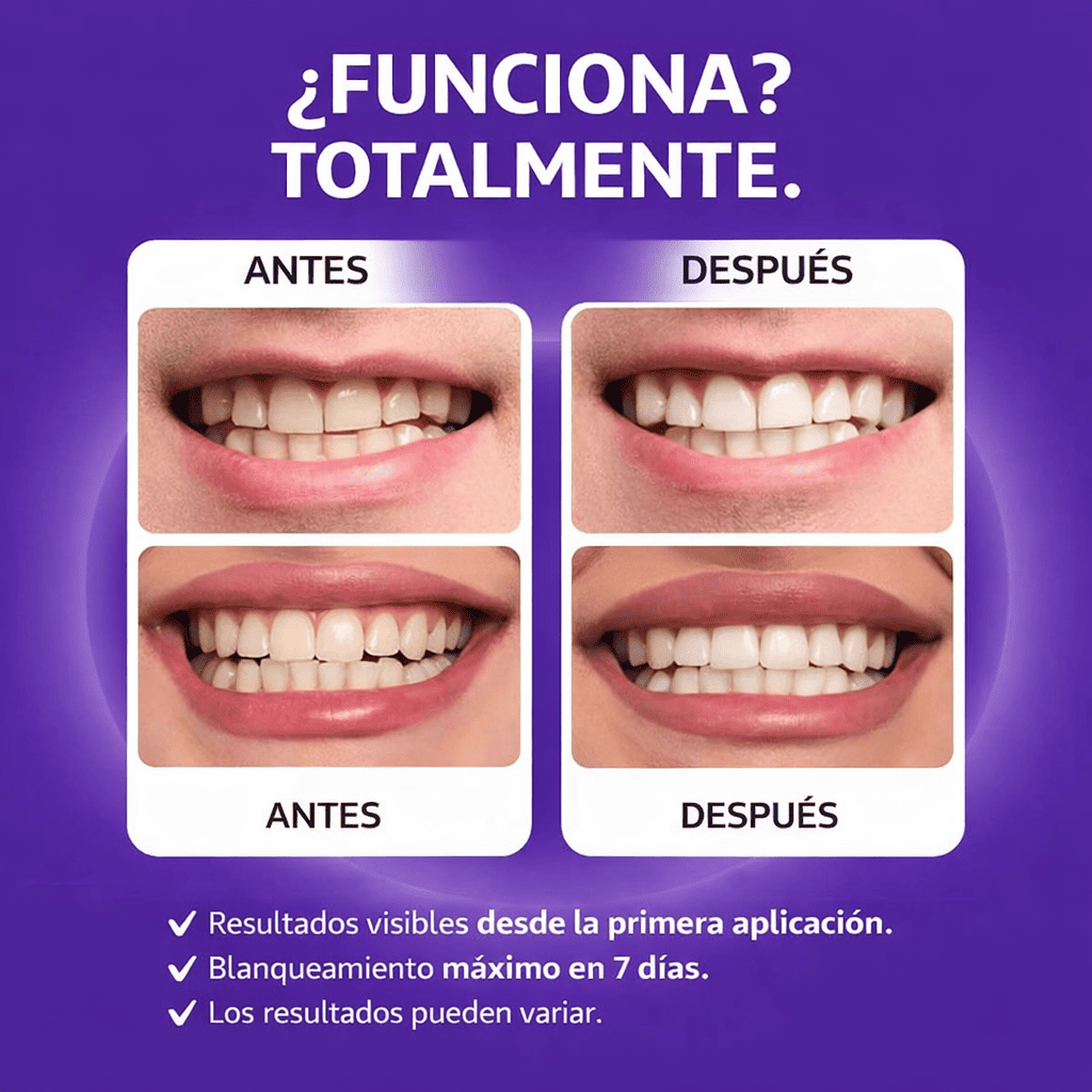 7D Teeth Whitening Strips x14