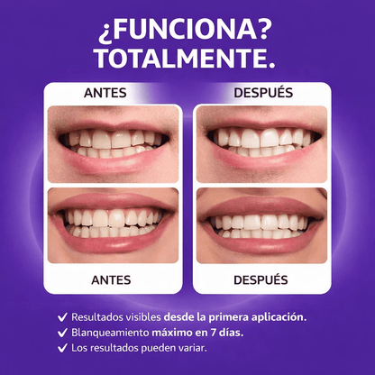 7D Teeth Whitening Strips x14